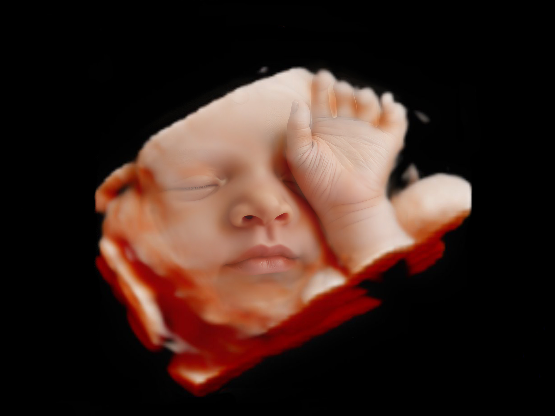 Echo transformatie - Afbeelding 2