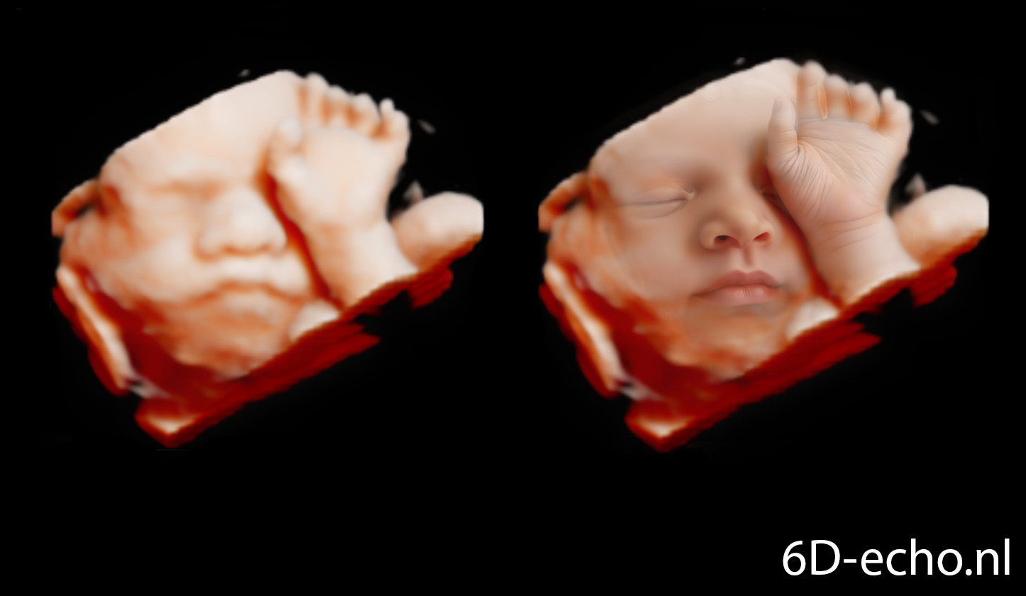 Echo transformatie - Afbeelding 3