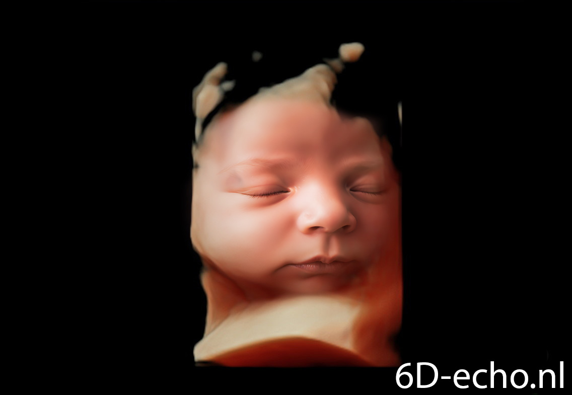 Echo transformatie - Afbeelding 5