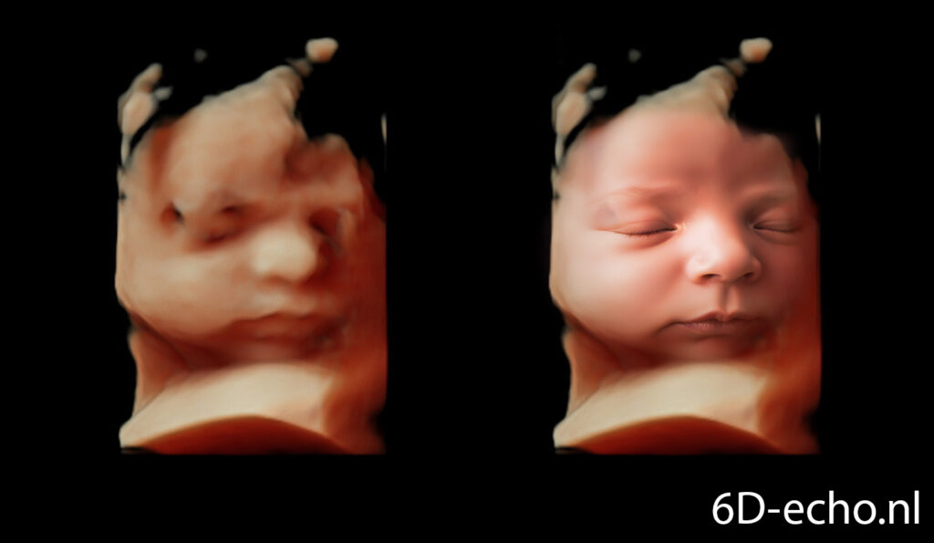 Baby voorbeeld vergelijking 1